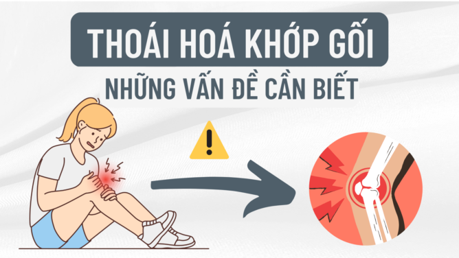 3 điều cần biết để phòng ngừa thoái hóa khớp gối hiệu quả 1 THOAI HOA KHOP GOI 1920 × 1080 px