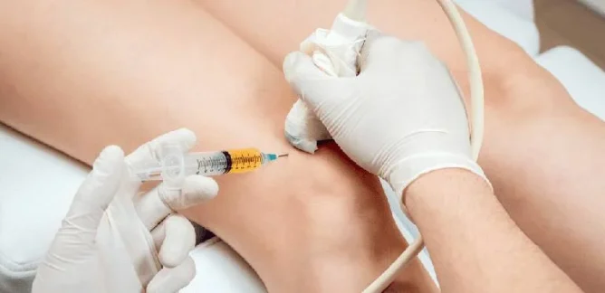 Loại Thuốc Tiêm Khớp Gối Phổ Biến Nhất 2024